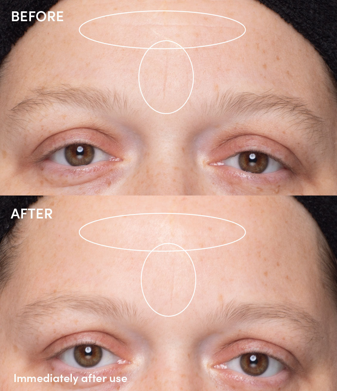 Chill Chocolate Vine Stress Mask before and after