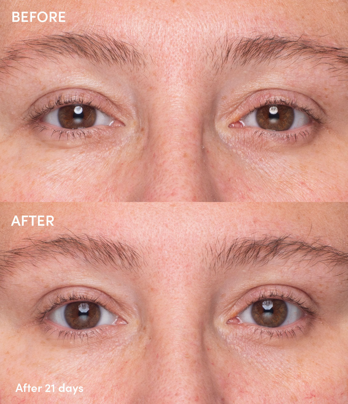 Chill Chocolate Vine Restorative Eye Balm before and after