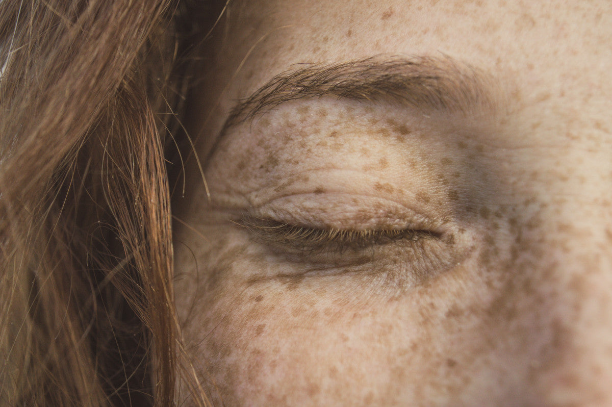dry skin under eyes