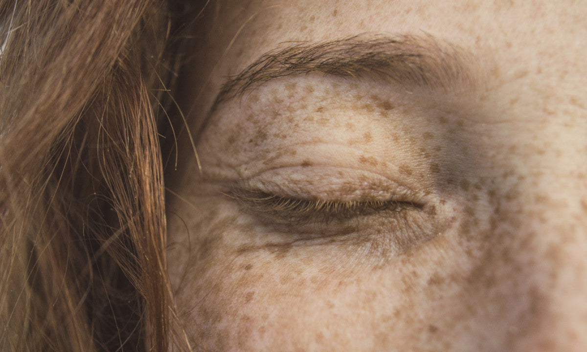 dry skin under eyes