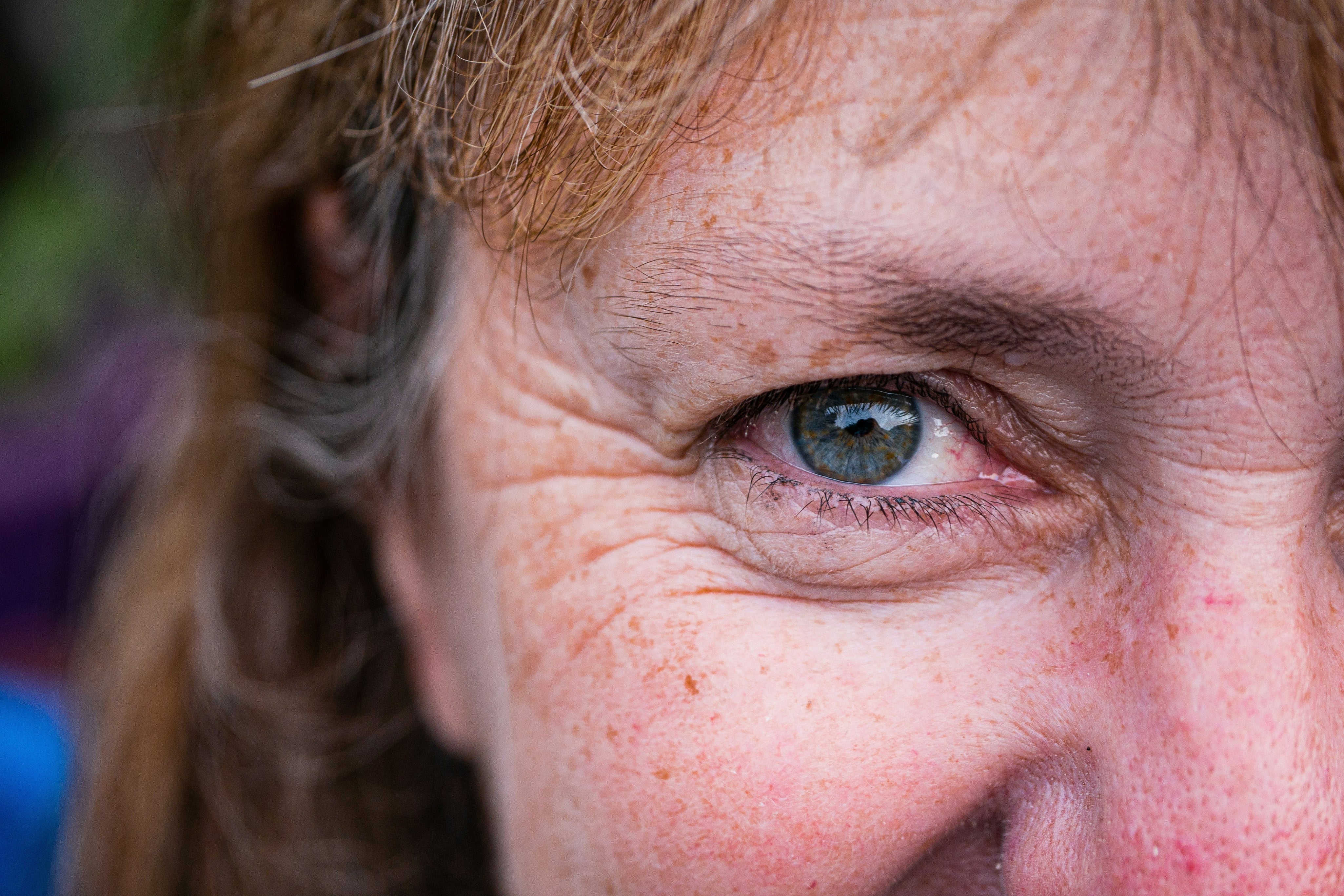 How to Reduce Wrinkles on Face Naturally