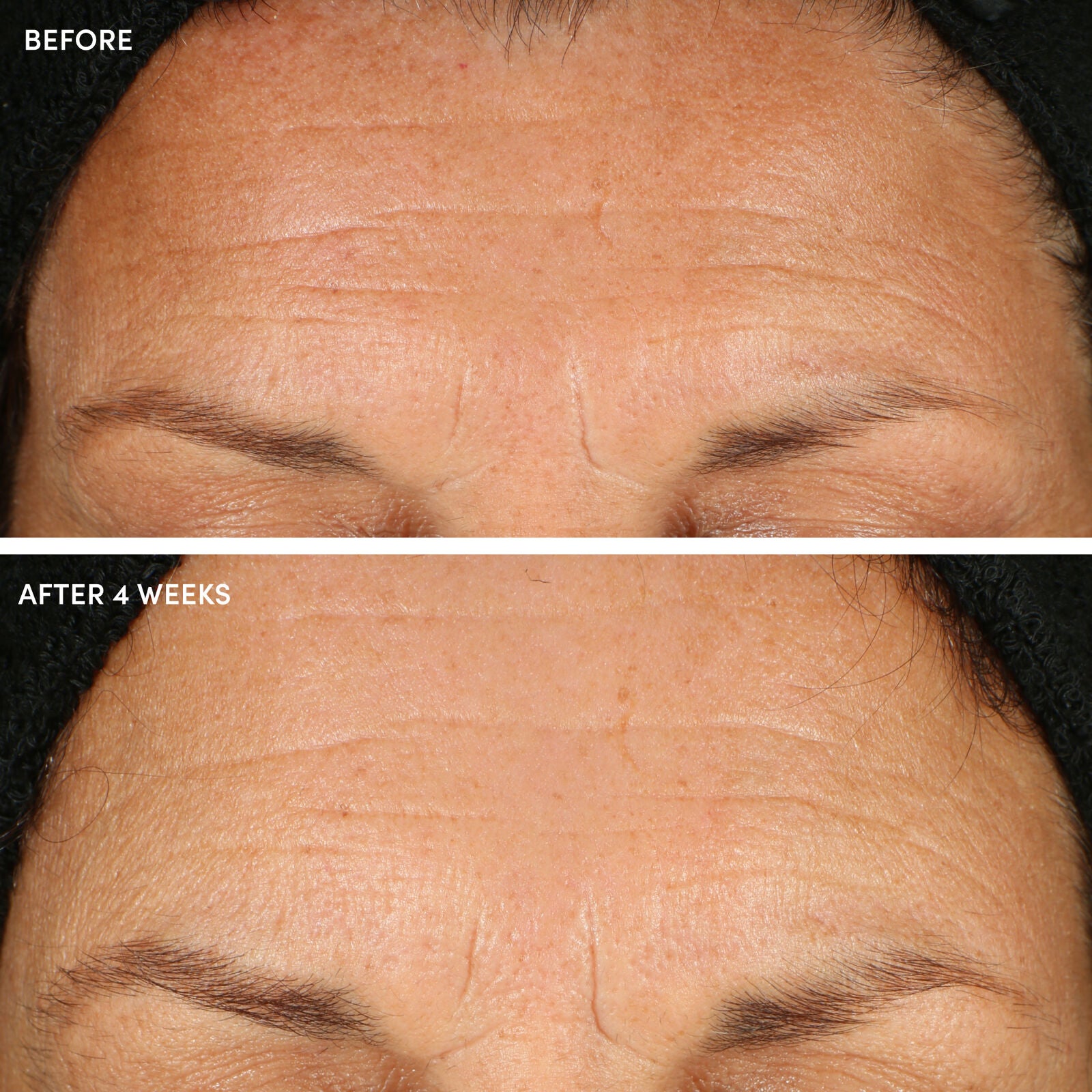 10% Glycolic Acid + Aloe Vera Resurfacing Pads