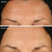 10% Glycolic Acid + Aloe Vera Resurfacing Pads