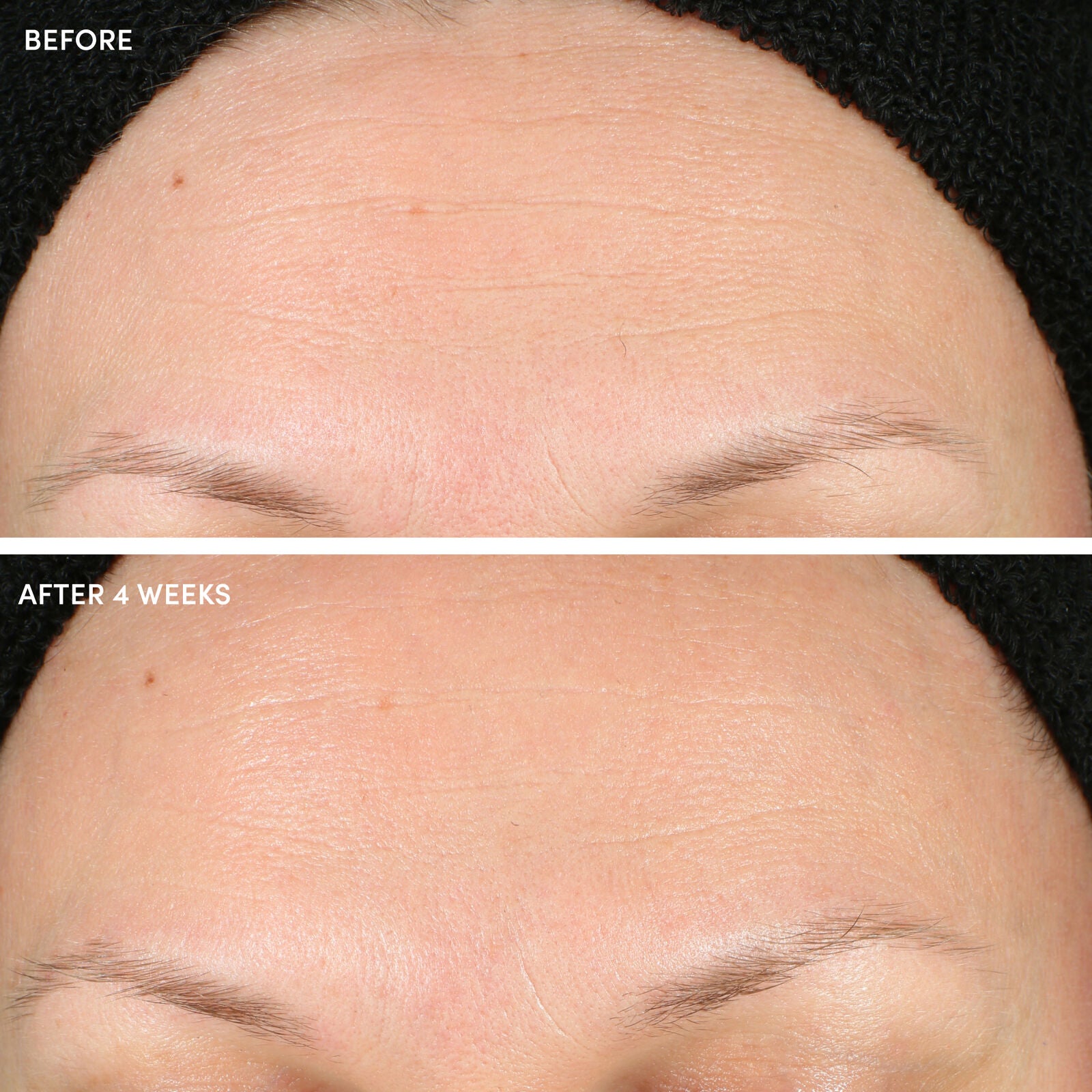 10% Glycolic Acid + Aloe Vera Resurfacing Pads