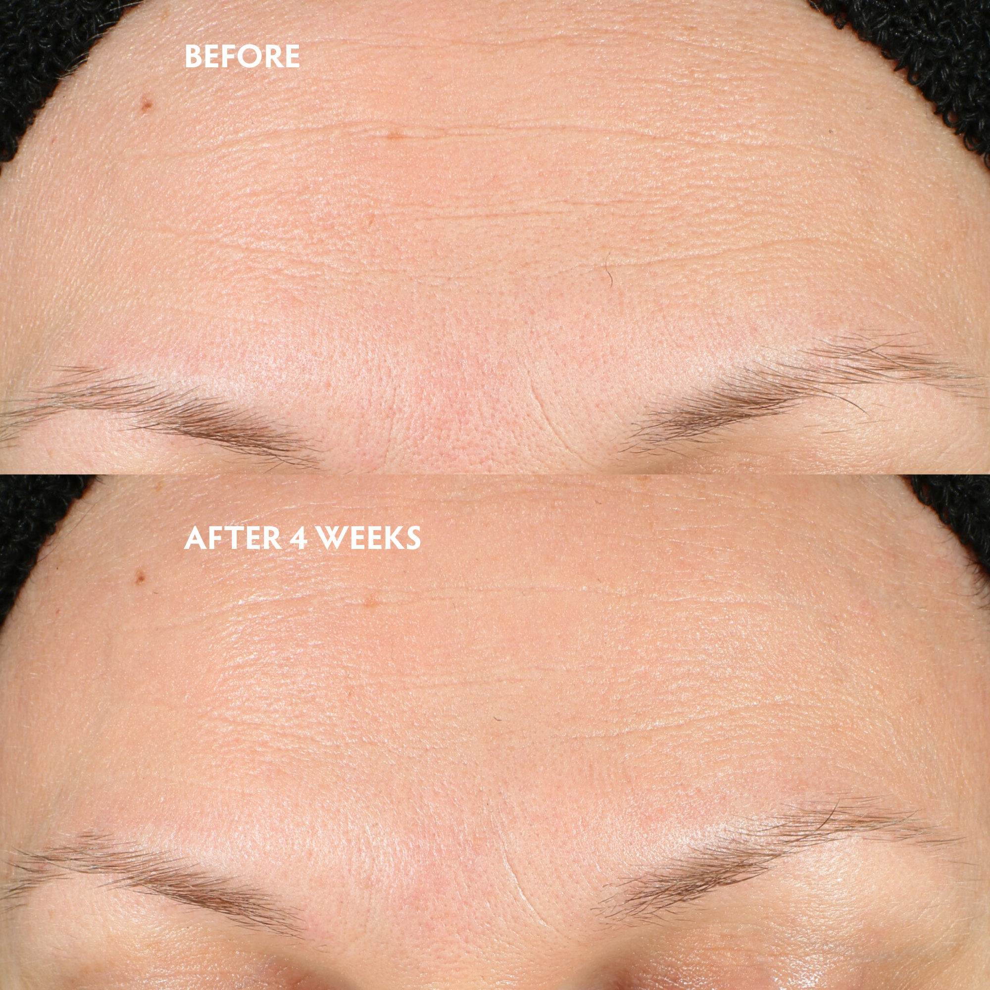 Before_After_Okendo_1e868228-6ad7-4c29-9113-9eac4712ba49.png