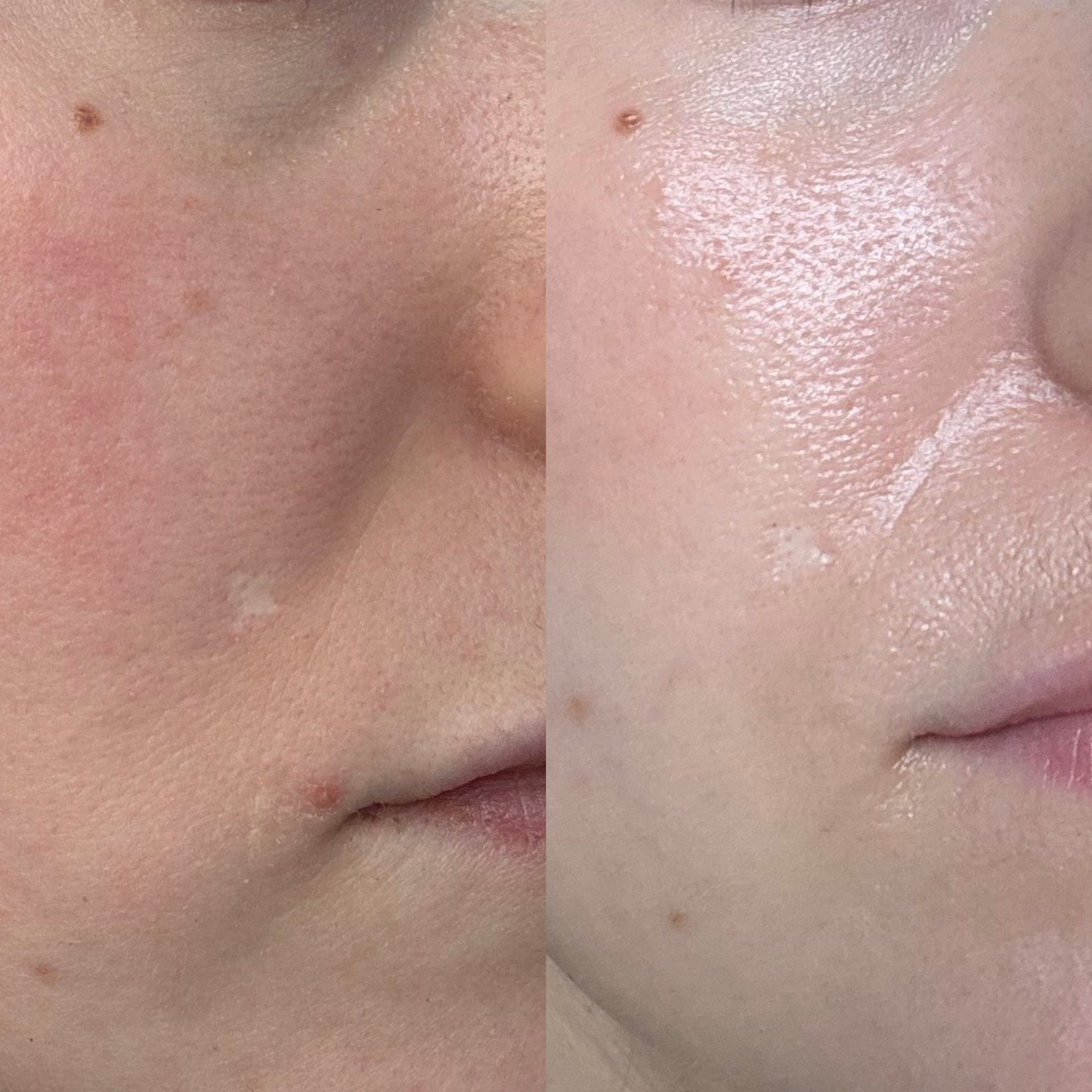 Calendula_Cream_Before_After_Okendo_1.png