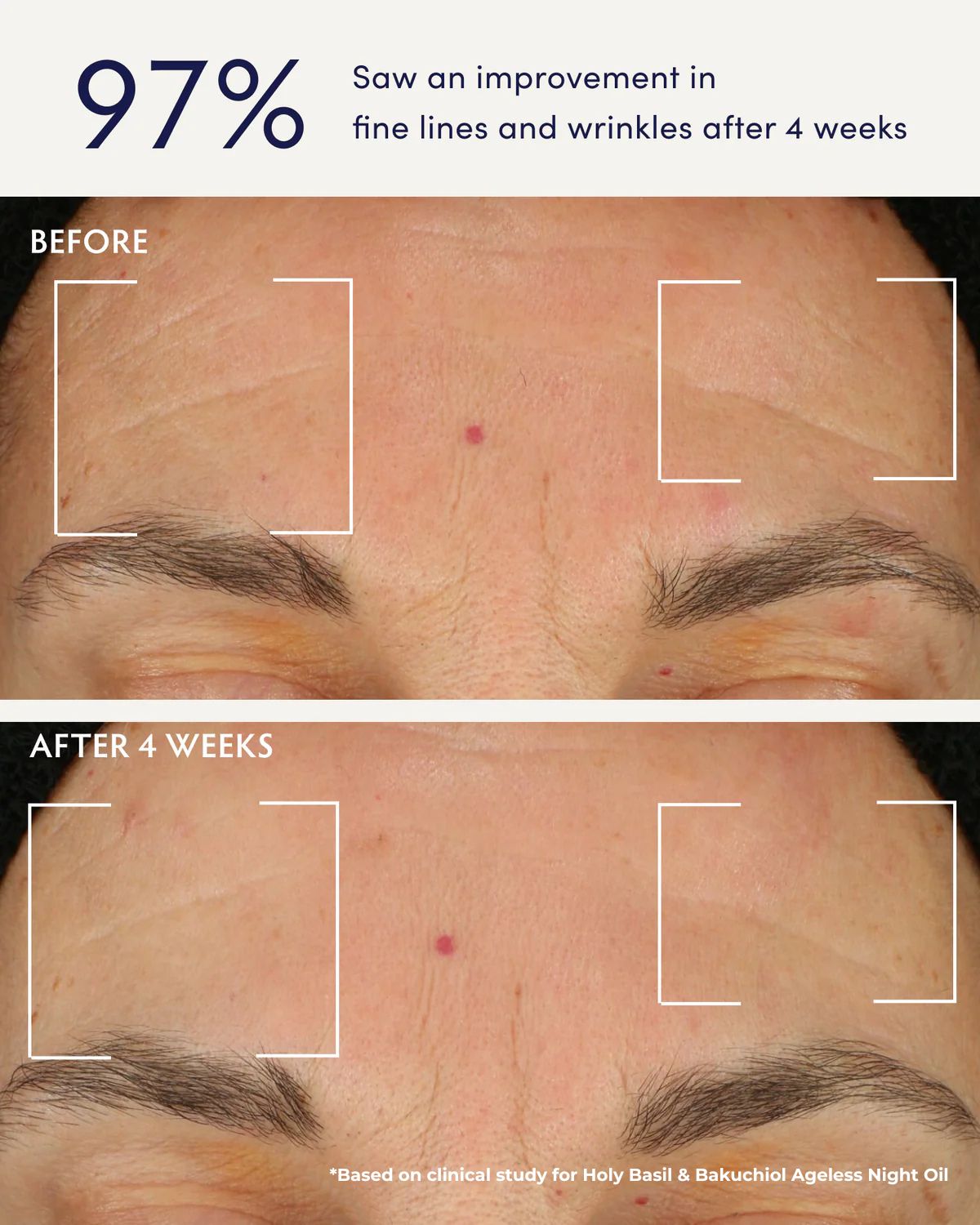 Clinical_Results_Before_After.jpg