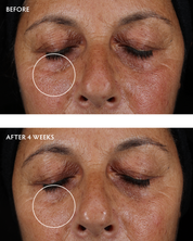 Caffeine + Peptide Smoothing Eye Serum