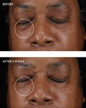 Caffeine + Peptide Smoothing Eye Serum