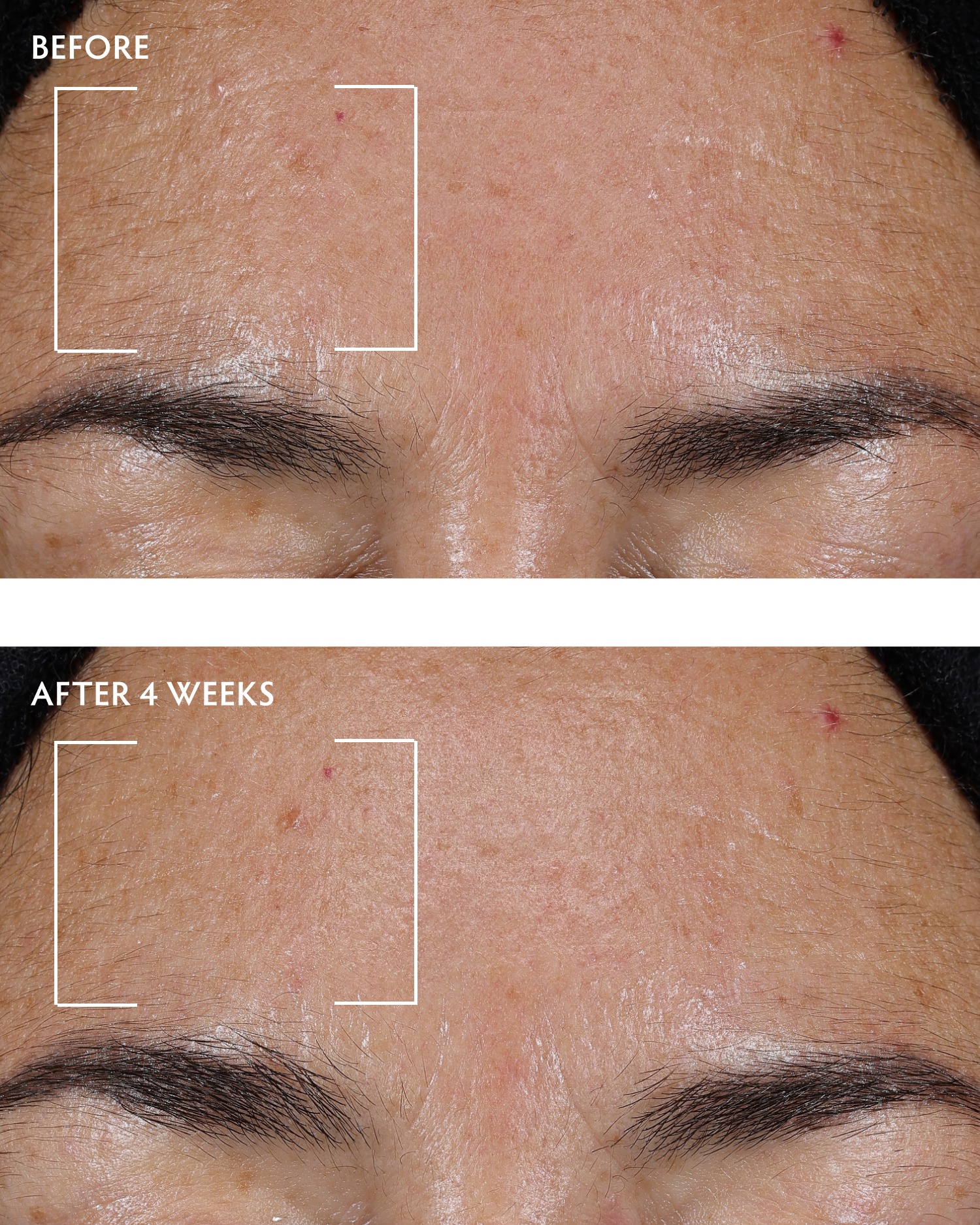 Caffeine + Peptide Face & Neck Serum
