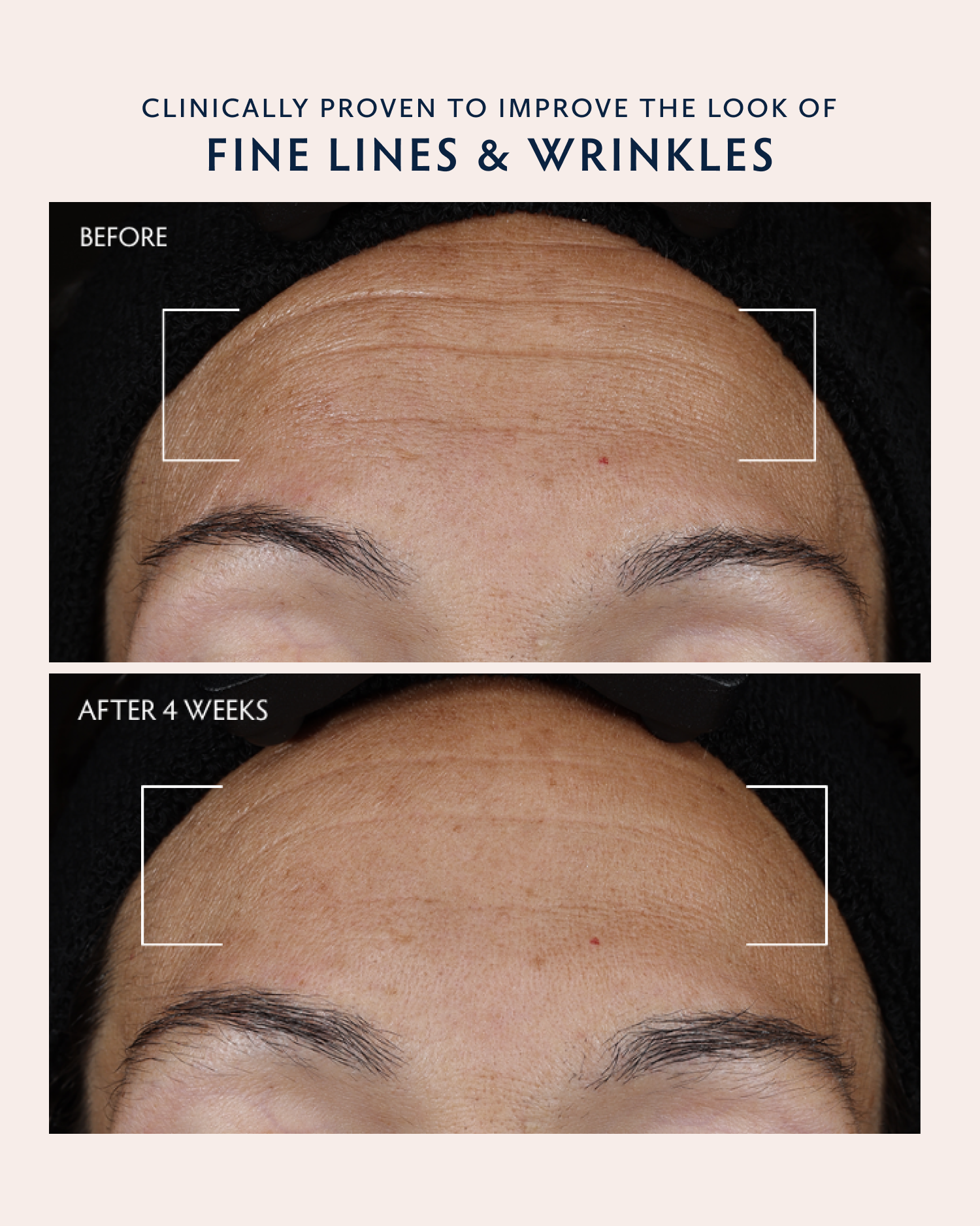 Before-and-after comparison of a person's forehead showing improvement in fine lines and wrinkles, with text reading 'Clinically proven to improve the look of fine lines & wrinkles' and 'Before' and 'After 4 weeks'.