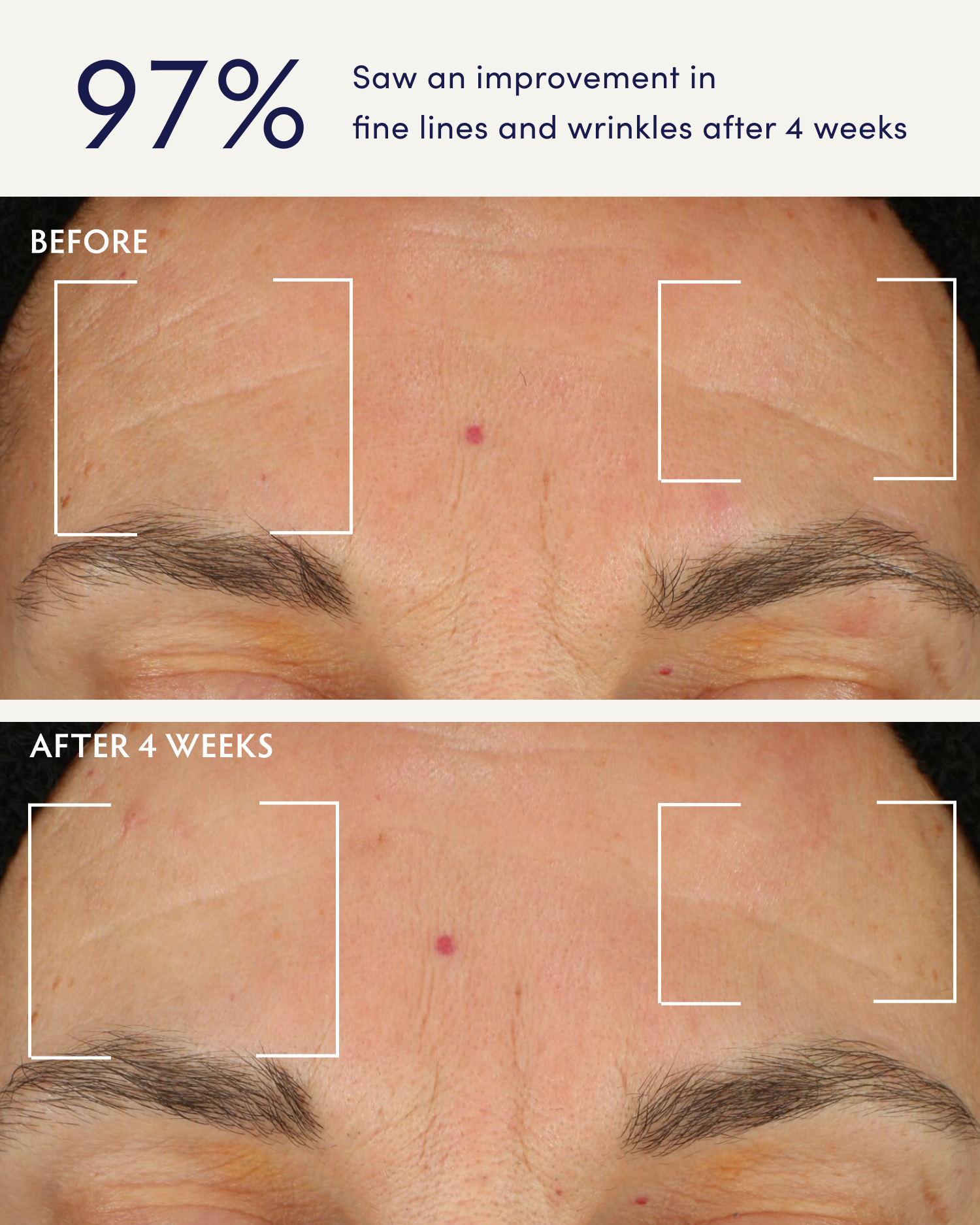 Holy Basil & Bakuchiol Ageless Night Oil