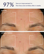 Holy Basil & Bakuchiol Ageless Night Oil