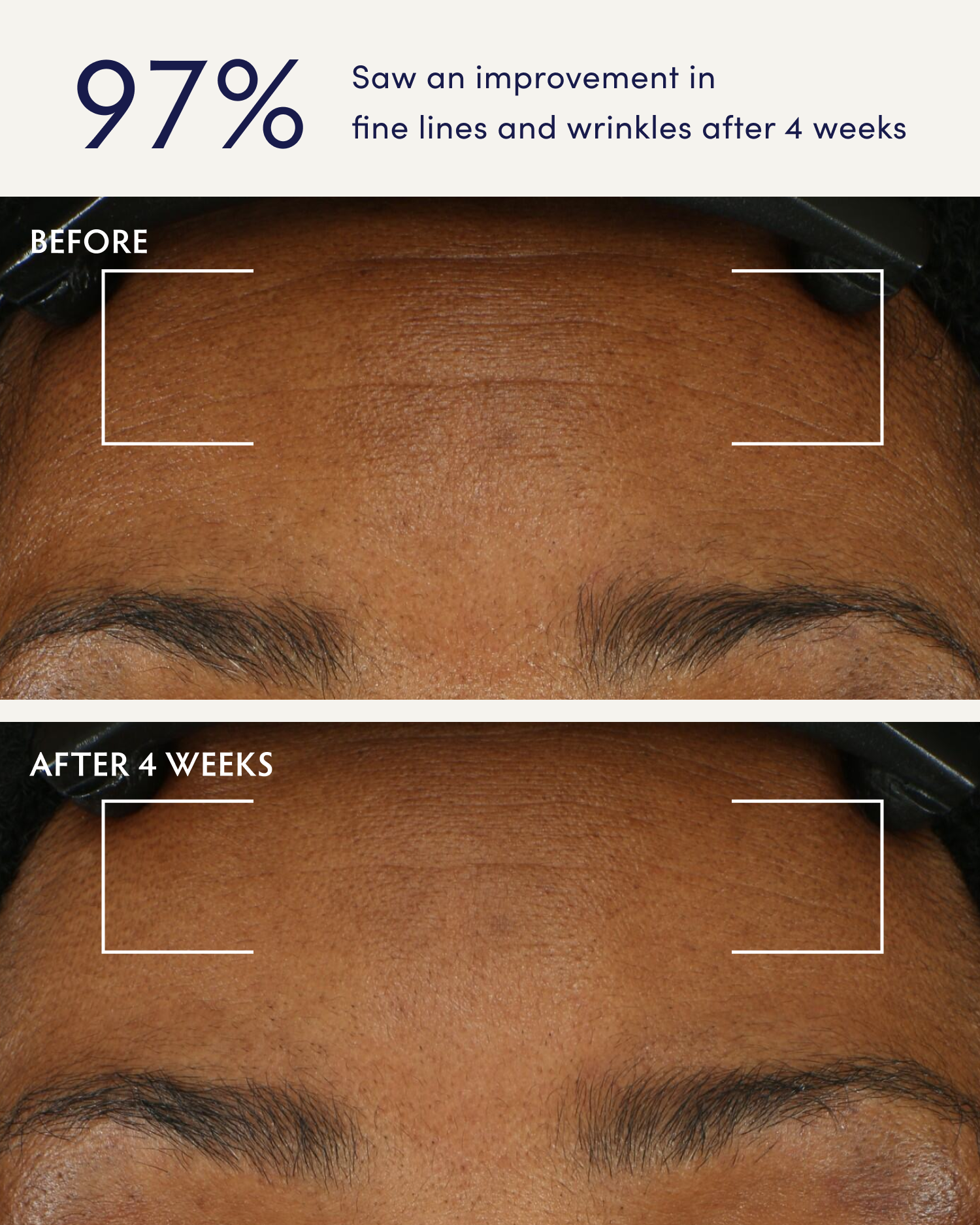 Holy Basil & Bakuchiol Ageless Night Oil