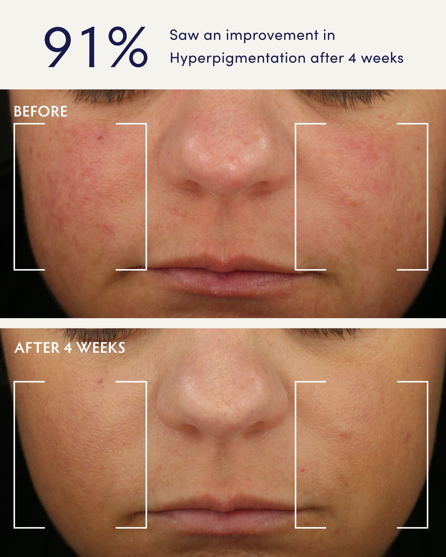 Holy Basil & Bakuchiol Ageless Night Oil